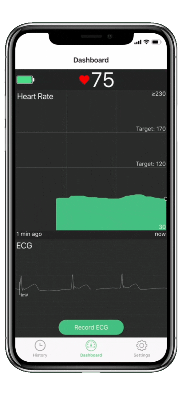 شاشة ECG / EKG يمكن ارتداؤها مع تحليل AI مراقبة هولتر ECG / EKG على